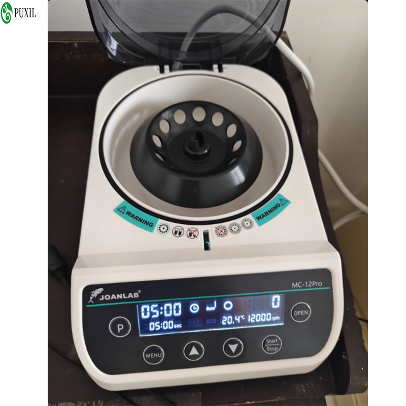 AB plasma centrifuge laborator - Blood Collection Tube 评论和价格